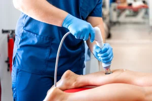 Ejemplo de aplicación de crioterapia local