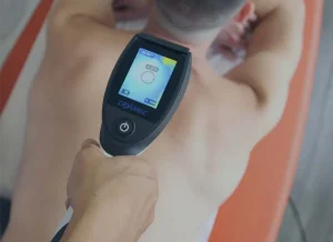 Ejemplo de aplicación de la crioterapia en fisioterapia
