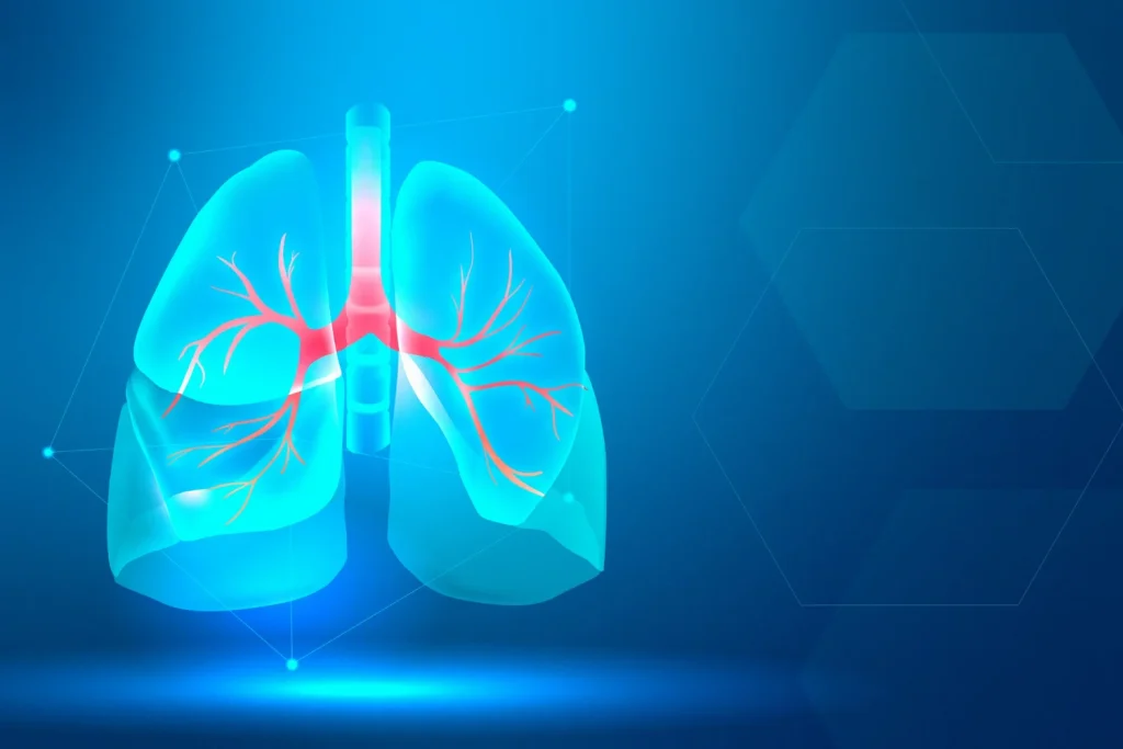 Lesiones pulmonares inducidas por la ventilación mecánica y cómo evitarlas